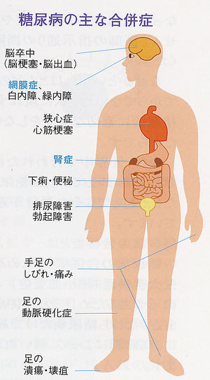 画像の説明